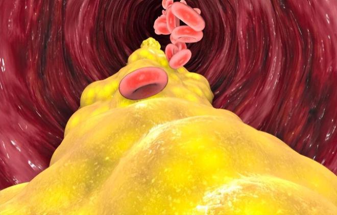 半岛·综合体育入口少吃肉、少吃油为什么血脂还是高？血液里的血脂到底从哪里来的(图1)